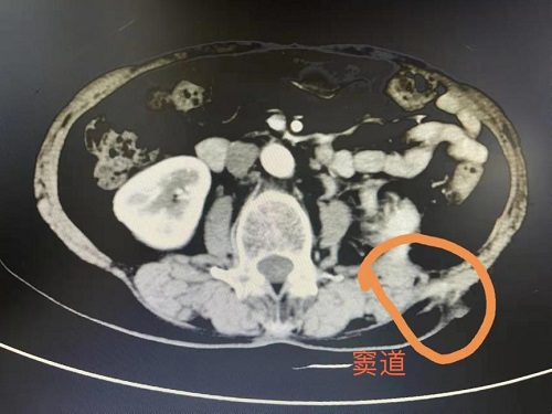 动态2.jpg 动态2.jpg