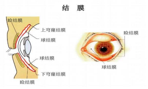 眼睛穹窿部位图片图片